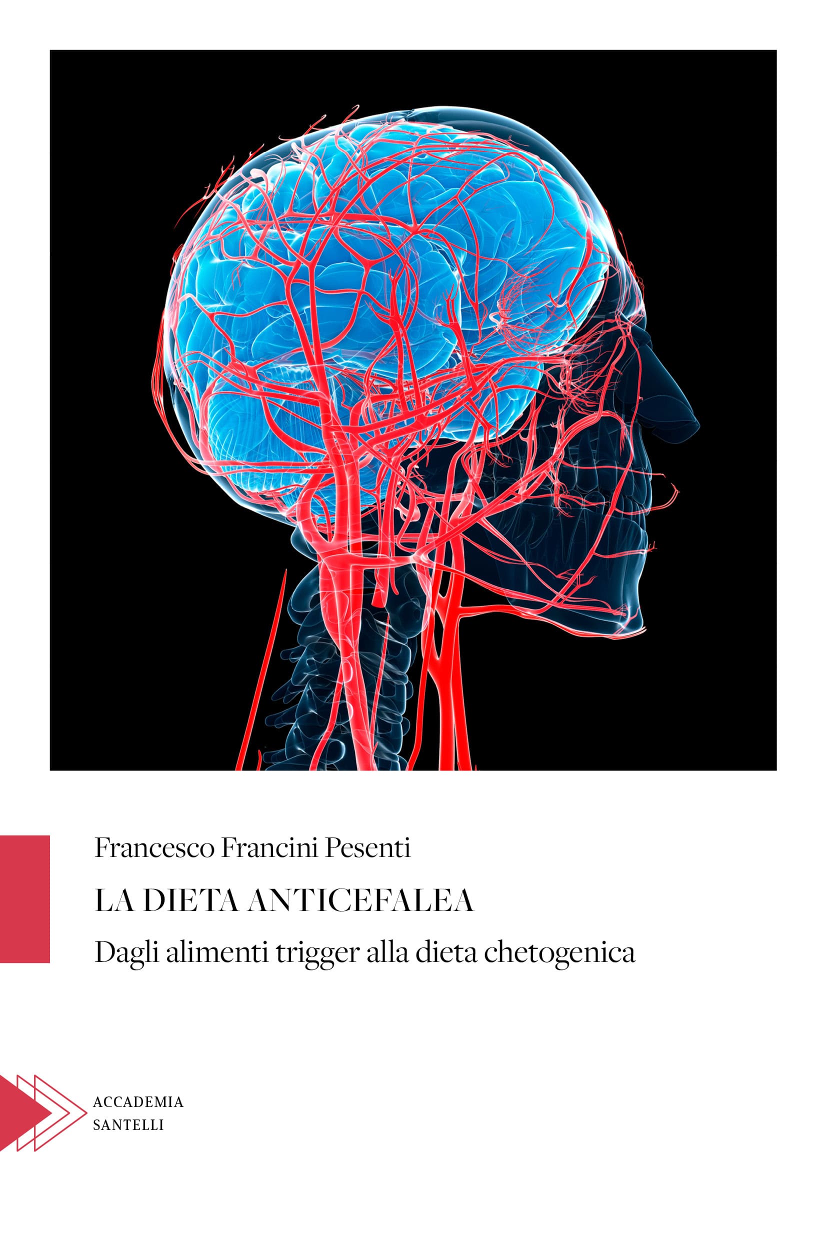 La dieta anticefalea